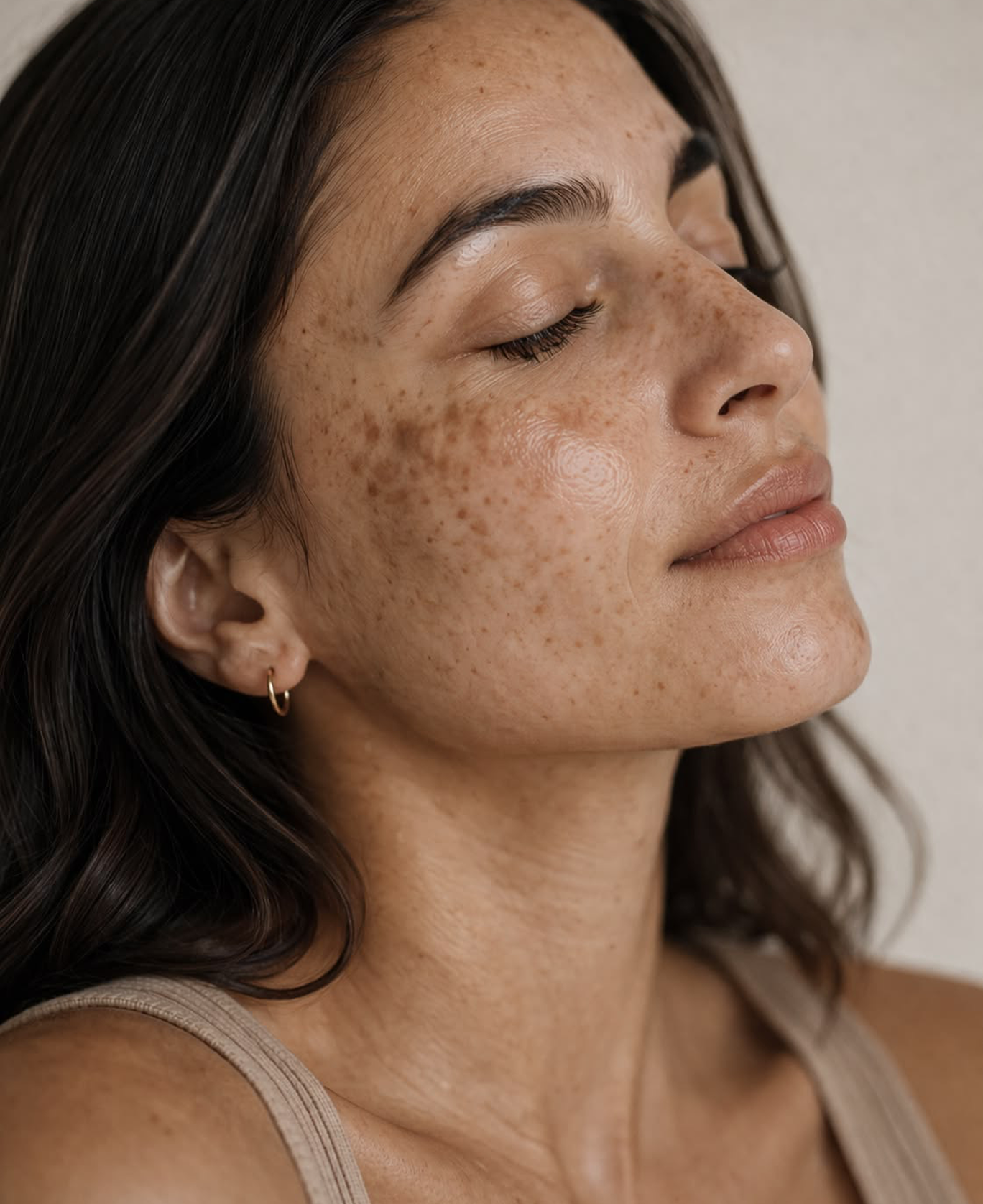 Pigmentation